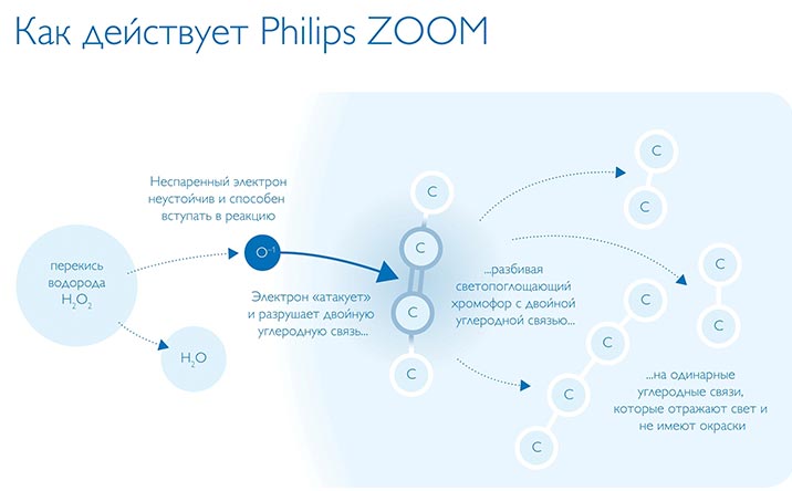 Принцип функционирования Philips ZOOM